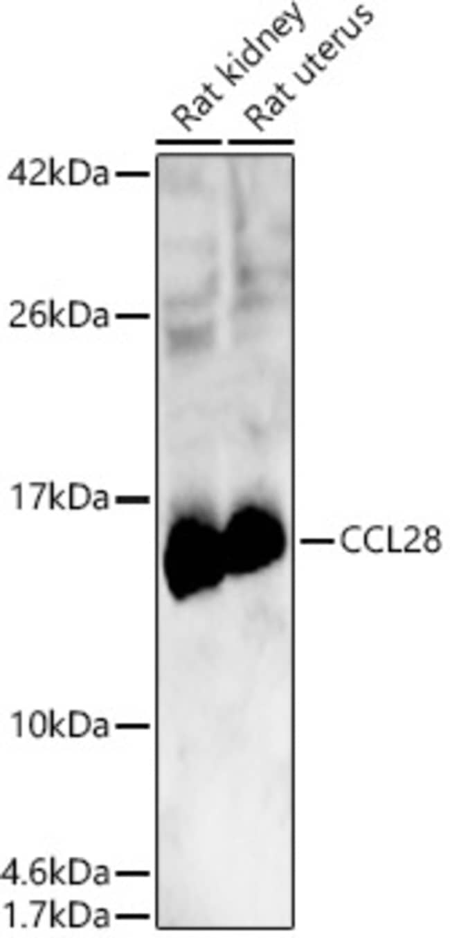 100UL CCL28 ANTIBODY 100 ul
