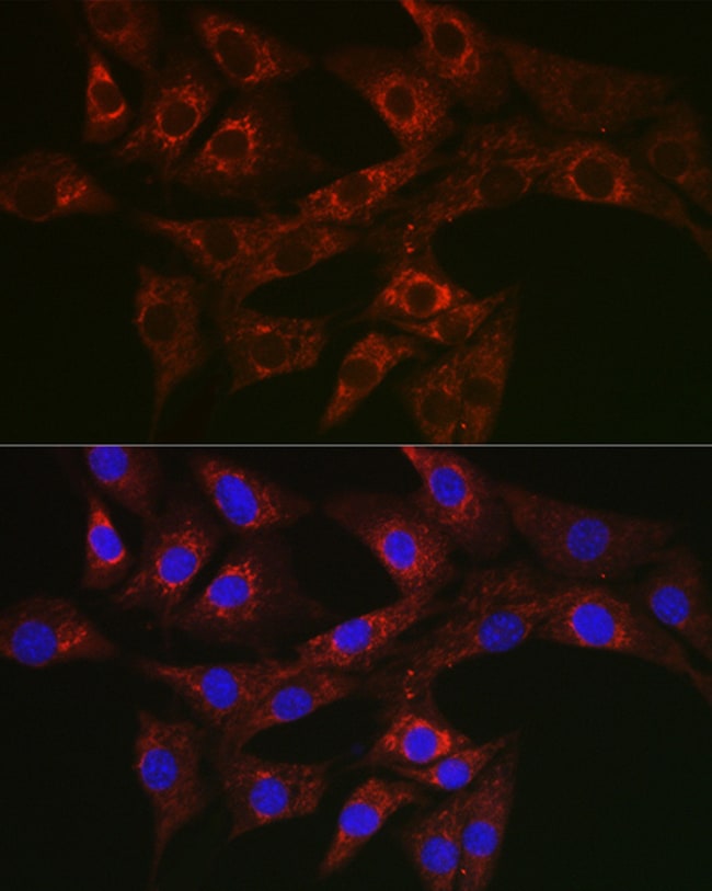 100UL ATG4A ANTIBODY 100 ul