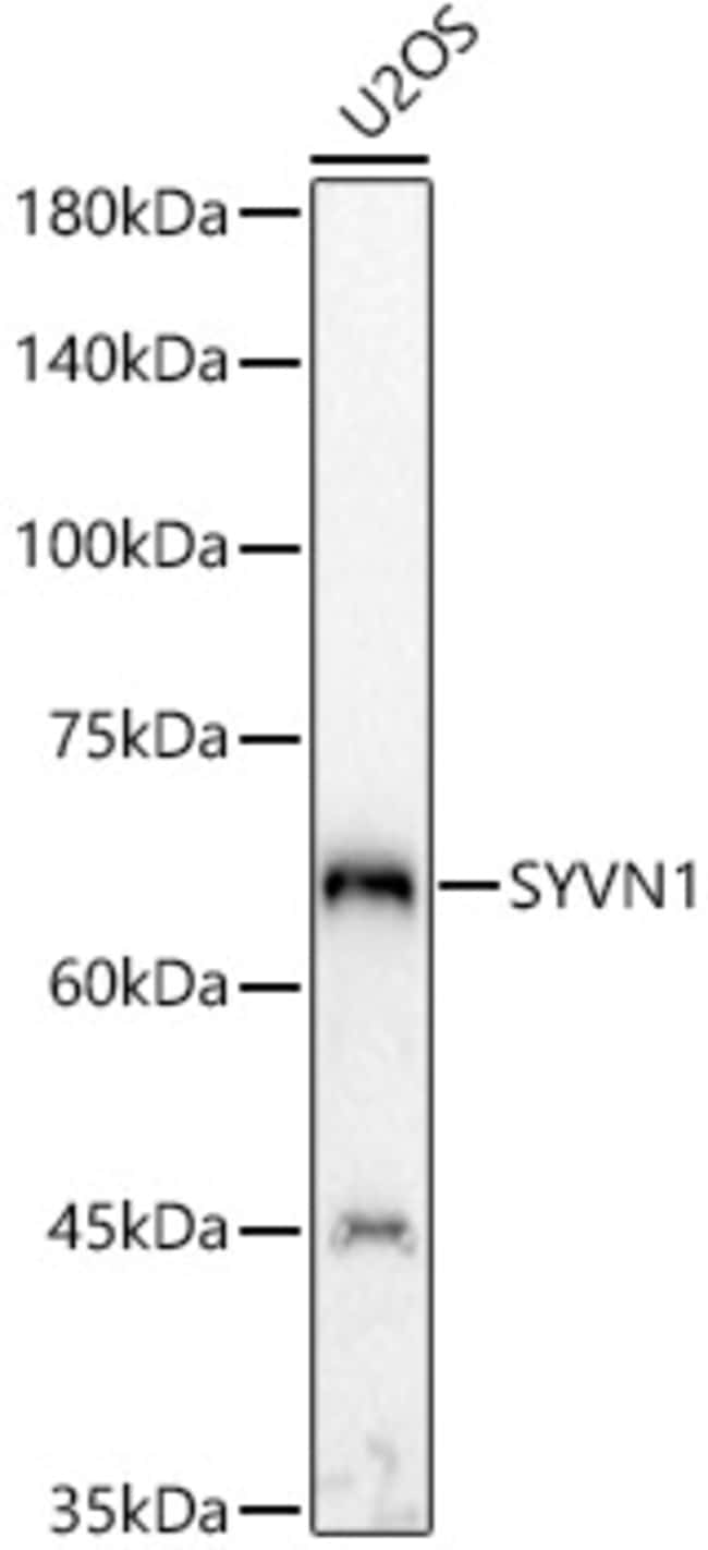 100UL HRD1 ANTIBODY 100 ul
