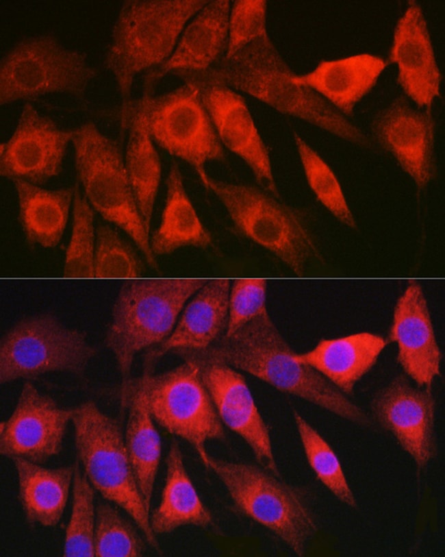 100UL LAMTOR5 ANTIBODY 100 ul
