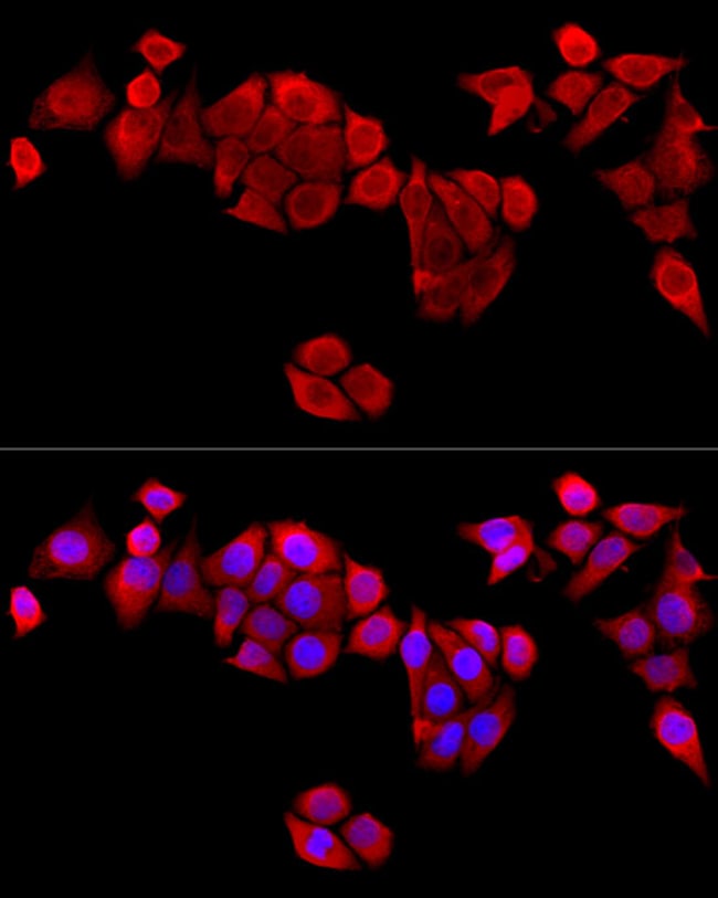 100UL EB1 ANTIBODY 100 ul