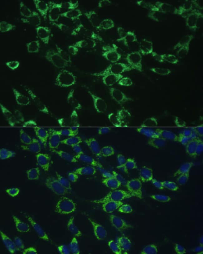 100UL COX5B ANTIBODY 100 ul