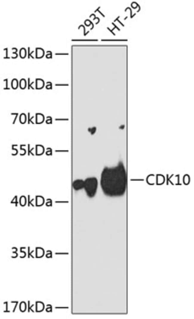 100UL CDK10 ANTIBODY 100 ul