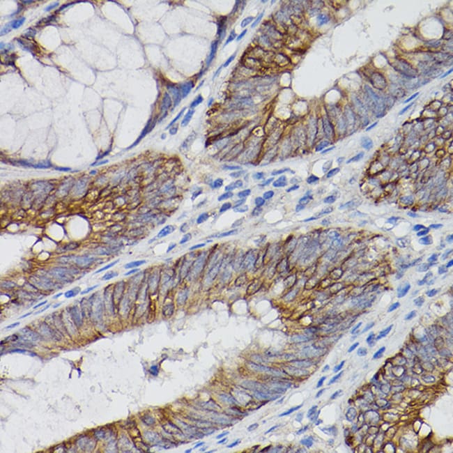 100UL IL-18RA ANTIBODY 100 ul