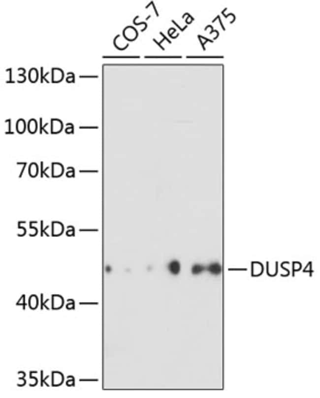 100UL MKP2 ANTIBODY 100 ul