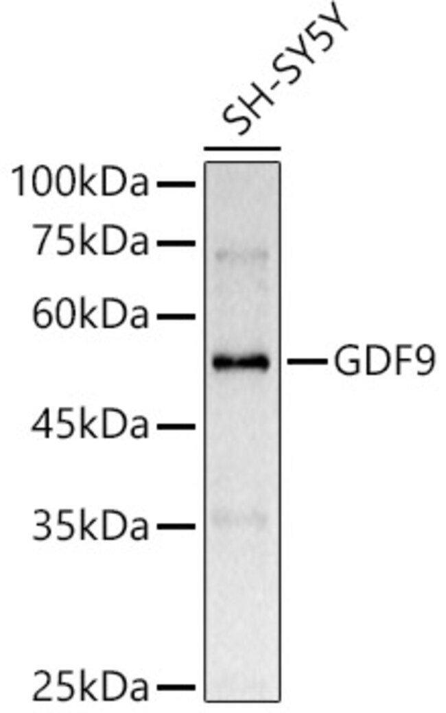 100UL GDF9 ANTIBODY 100 ul