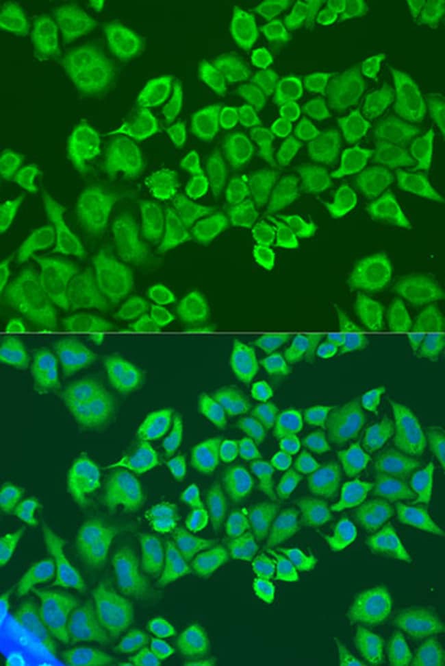 100UL IGF2BP2 ANTIBODY 100 ul