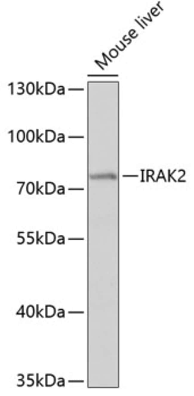 100UL IRAK2 ANTIBODY 100 ul