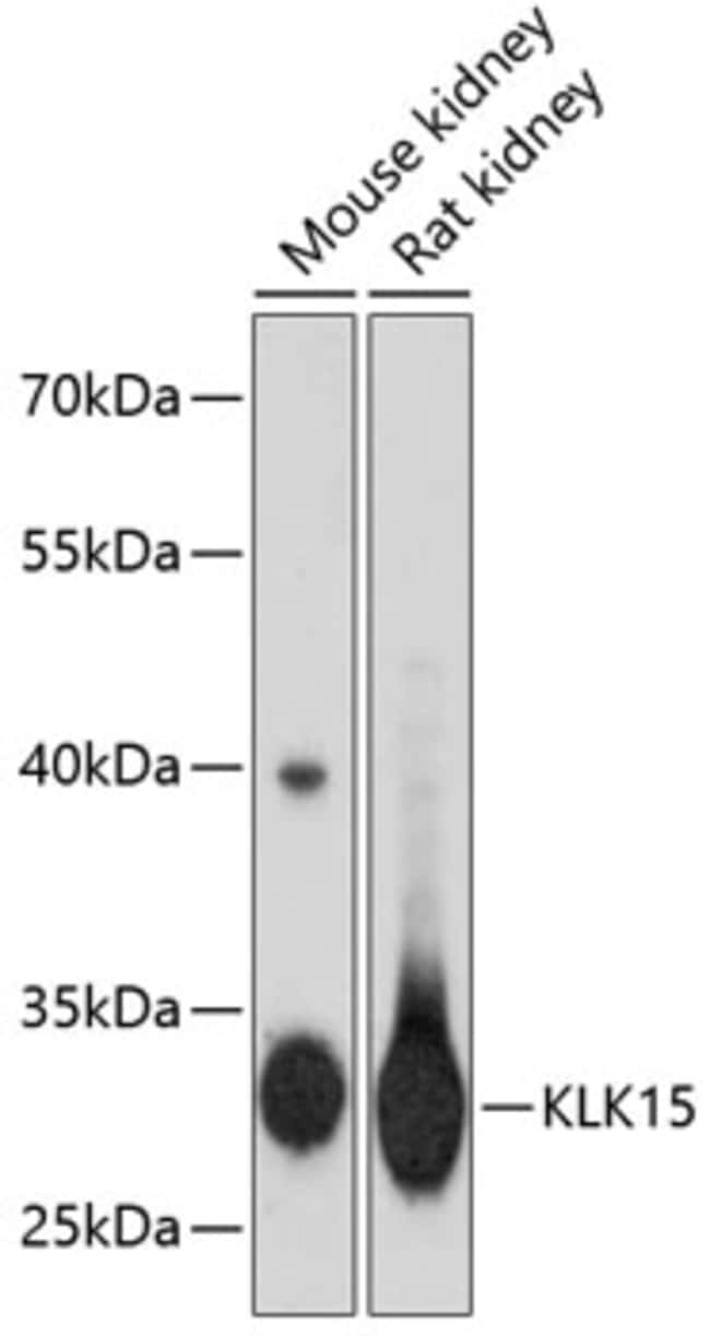 100UL KALLIKREIN 15 ANTIBODY 100 ul