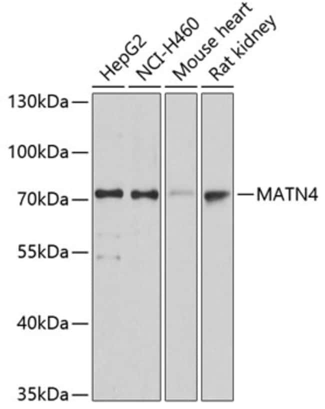 100UL MATN4 ANTIBODY 100 ul