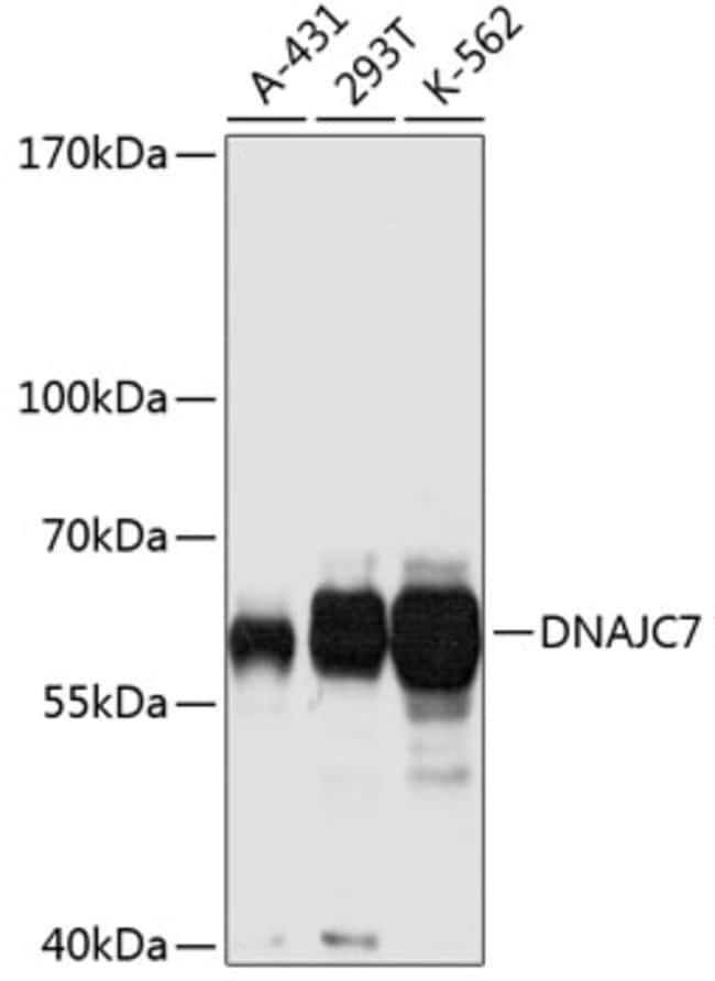 100UL DNAJC7 ANTIBODY 100 ul