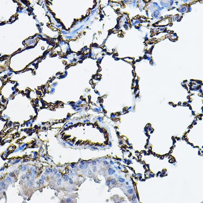 100UL ACE ANTIBODY 100 ul