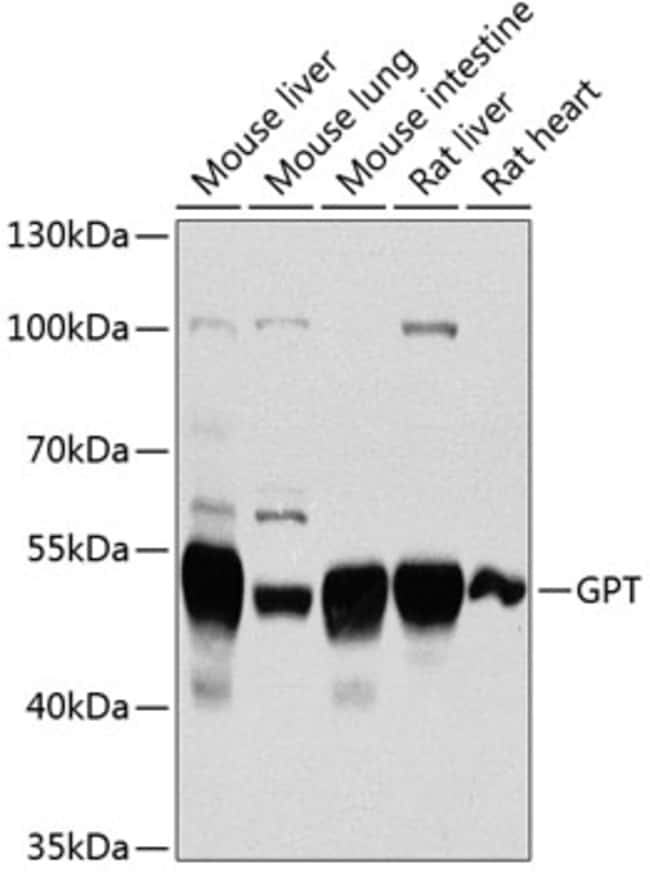 100UL GPT ANTIBODY 100 ul