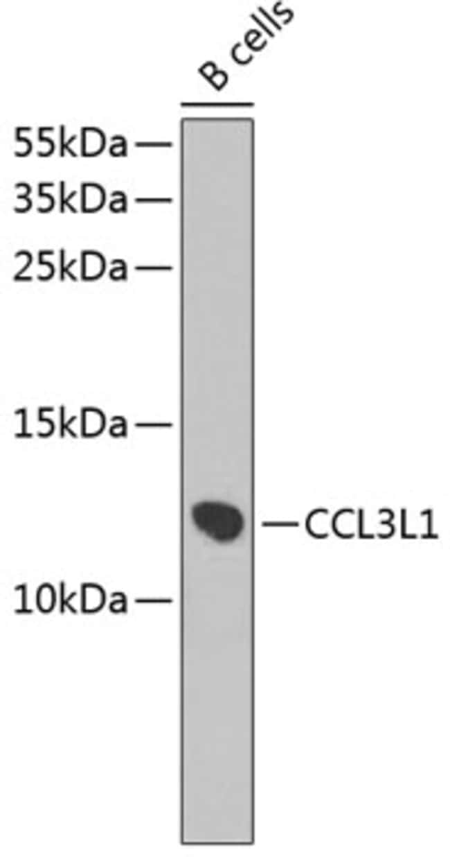 100UL CCL3L1 ANTIBODY 100 ul