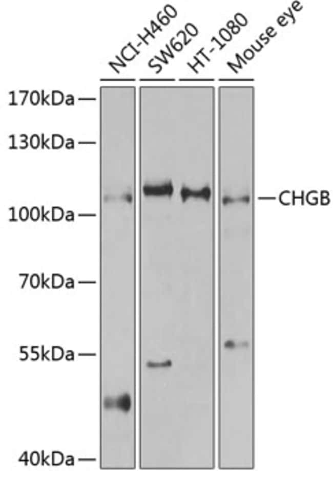 100UL CHROMOGRANIN B ANTIBODY 100 ul