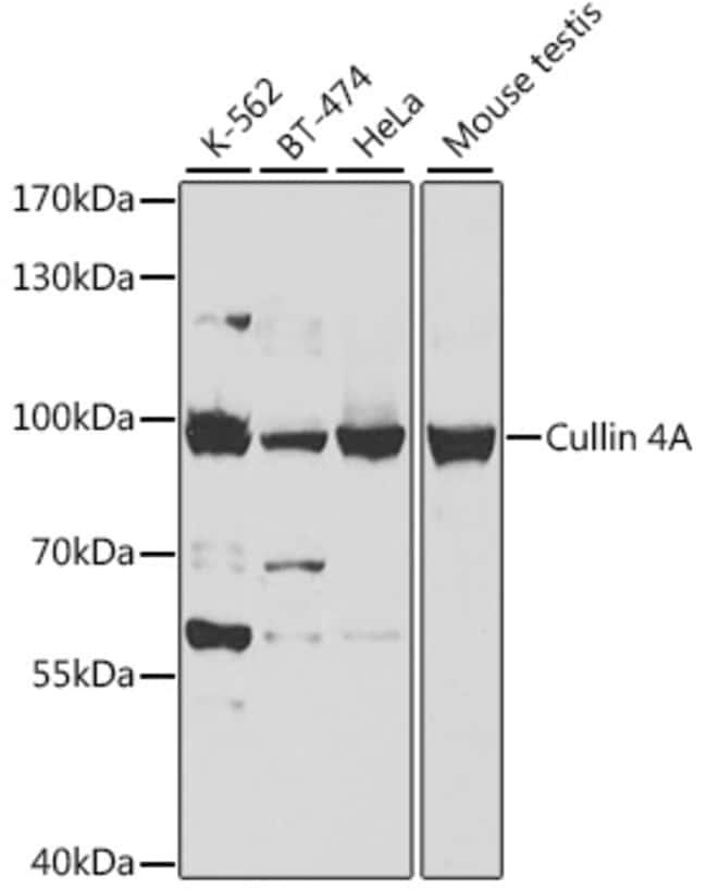 100UL CULLIN 4A ANTIBODY 100 ul