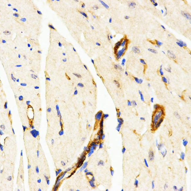 100UL LAMP3 ANTIBODY 100 ul