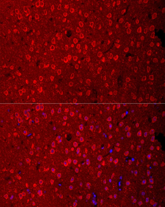 100UL EAAC1 ANTIBODY 100 ul