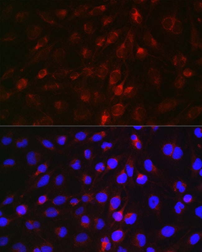 100UL EDA ANTIBODY 100 ul
