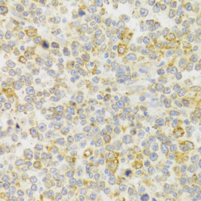 100UL KISS1R ANTIBODY 100 ul