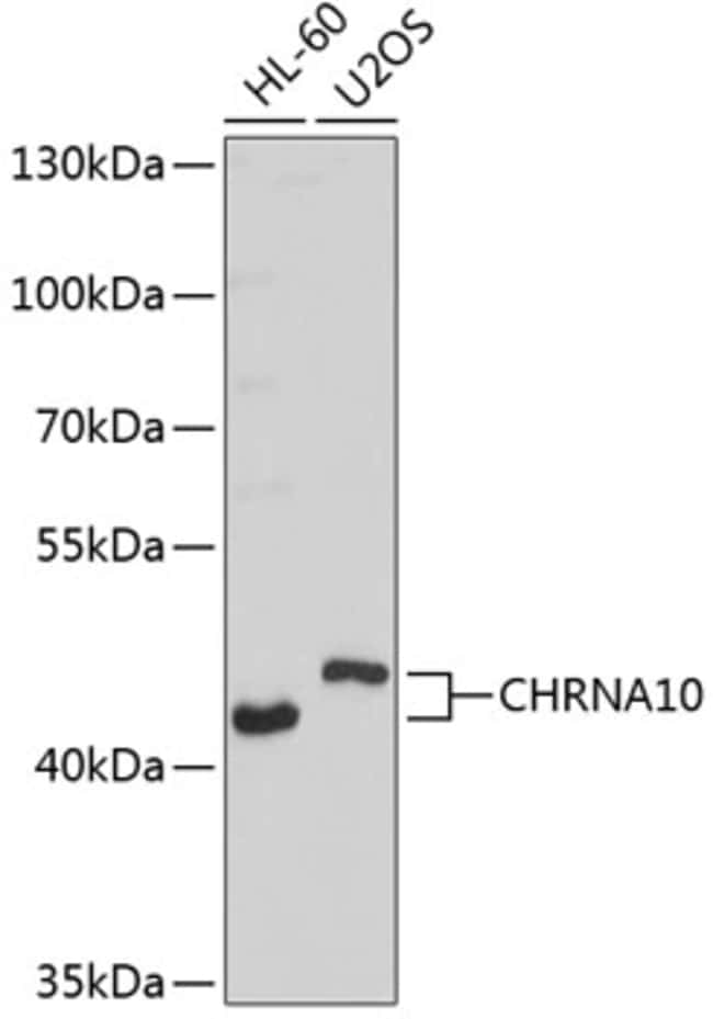 100UL CHRNA10 ANTIBODY 100 ul