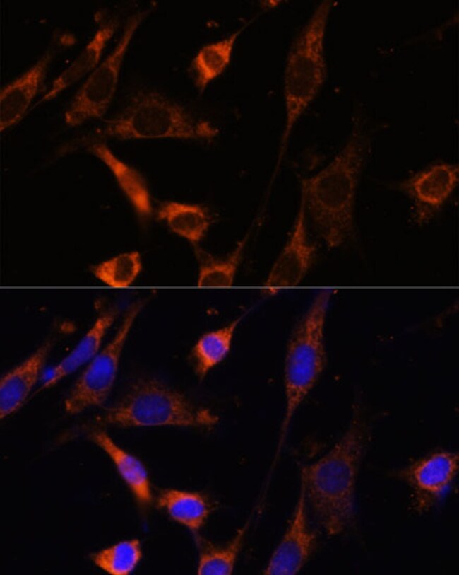 100UL CREATINE KINASE MT ANTIBODY 100 ul