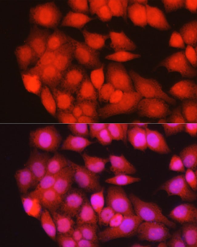 100UL MURF1 ANTIBODY 100 ul