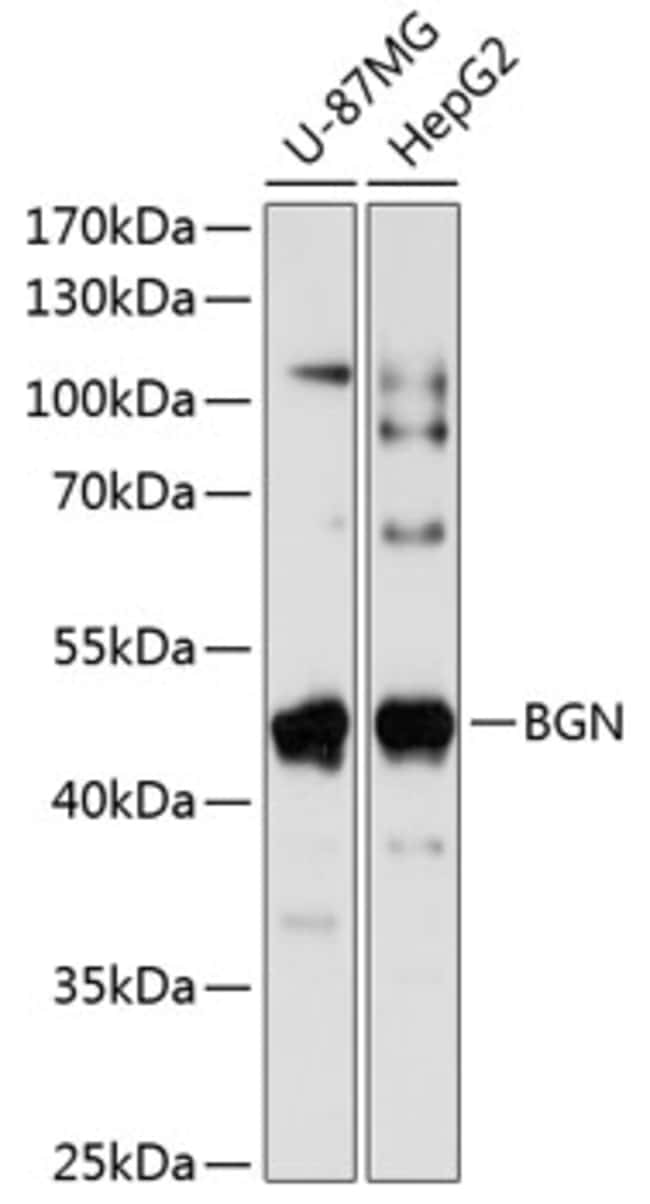 100UL BIGLYCAN ANTIBODY 100 ul