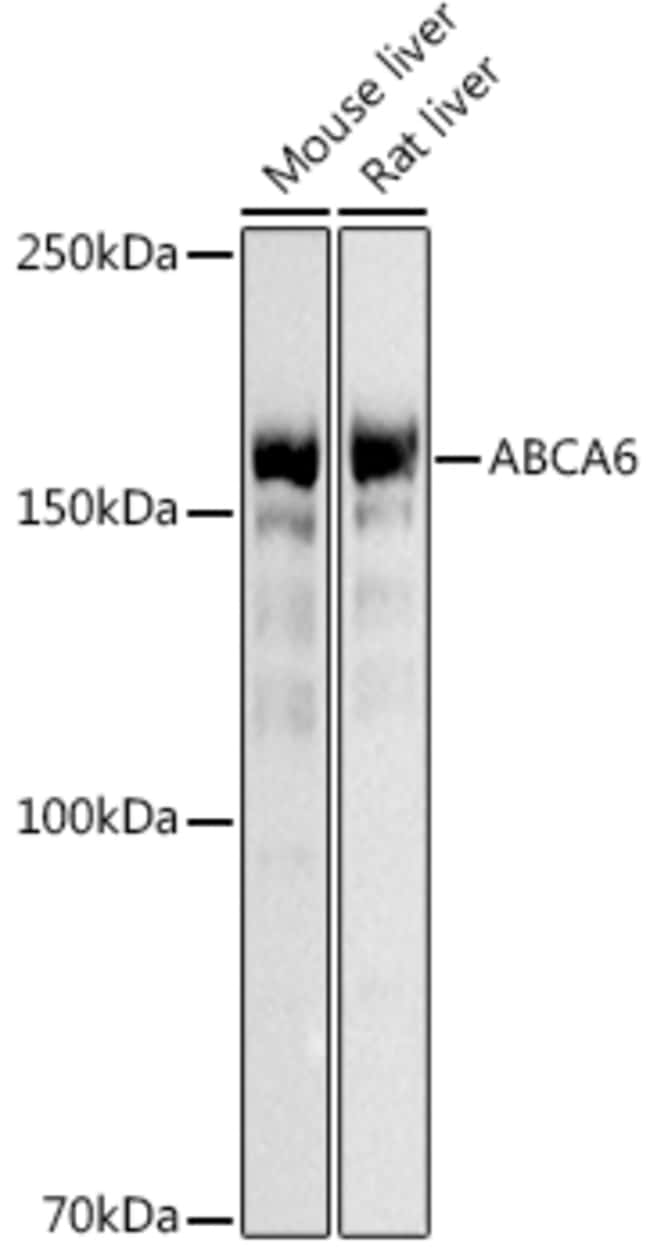 100UL ABCA6 ANTIBODY 100 ul