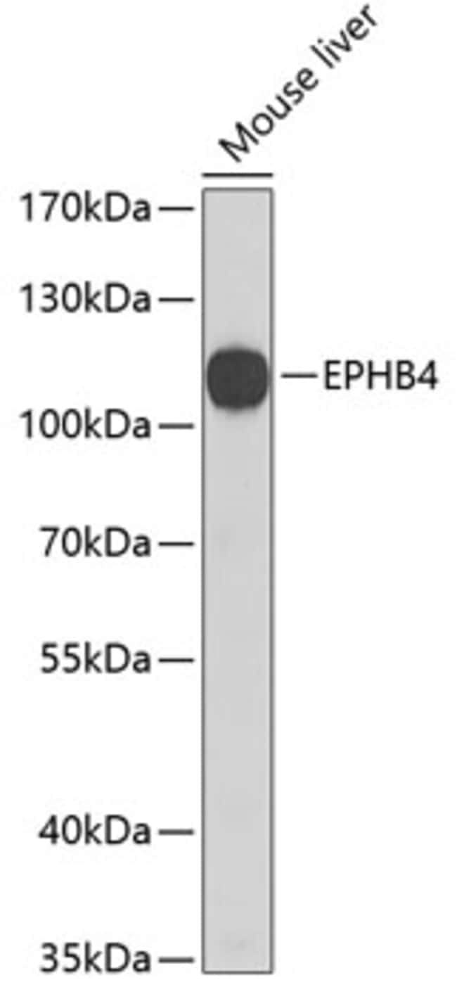 100UL EPHB4 ANTIBODY 100 ul
