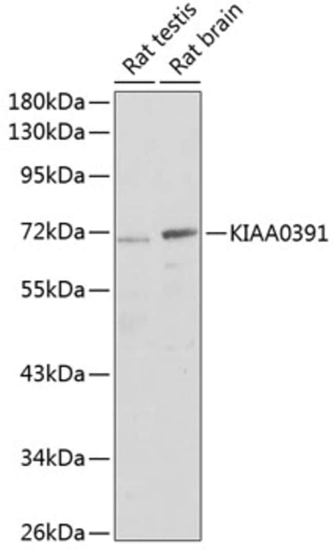100UL KIAA0391 ANTIBODY 100 ul