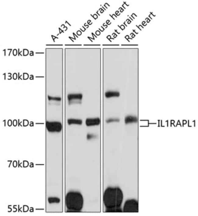 100UL IL1RAPL1 ANTIBODY 100 ul