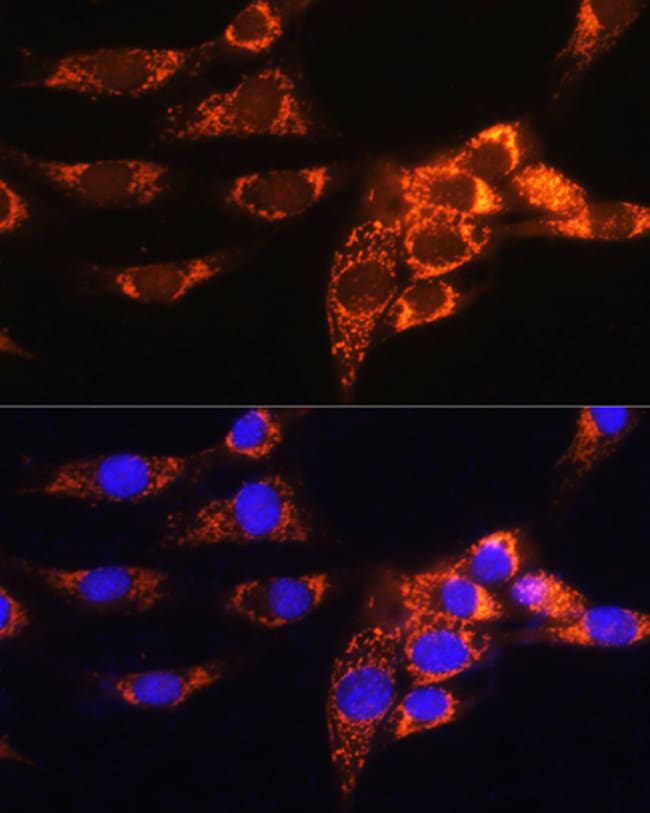 100UL AMPD1 ANTIBODY 100 ul