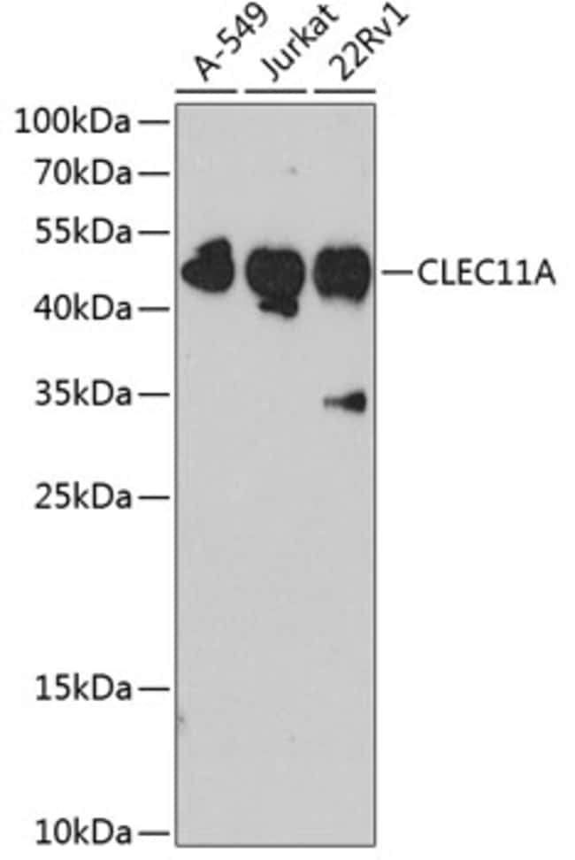 100UL CLEC11A ANTIBODY 100 ul