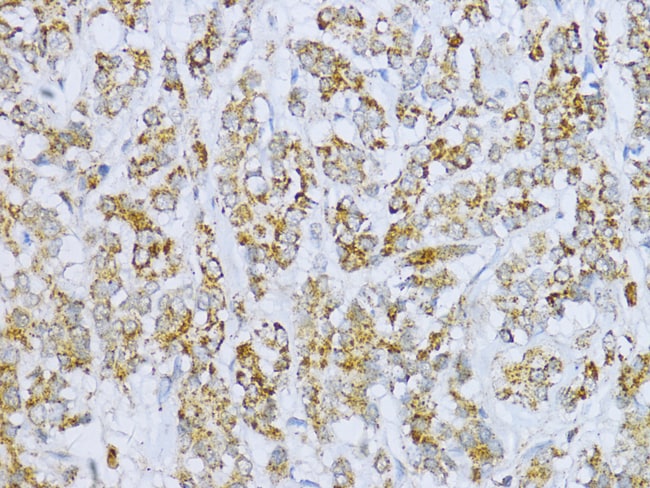 100UL ACONITASE 2 ANTIBODY 100 ul