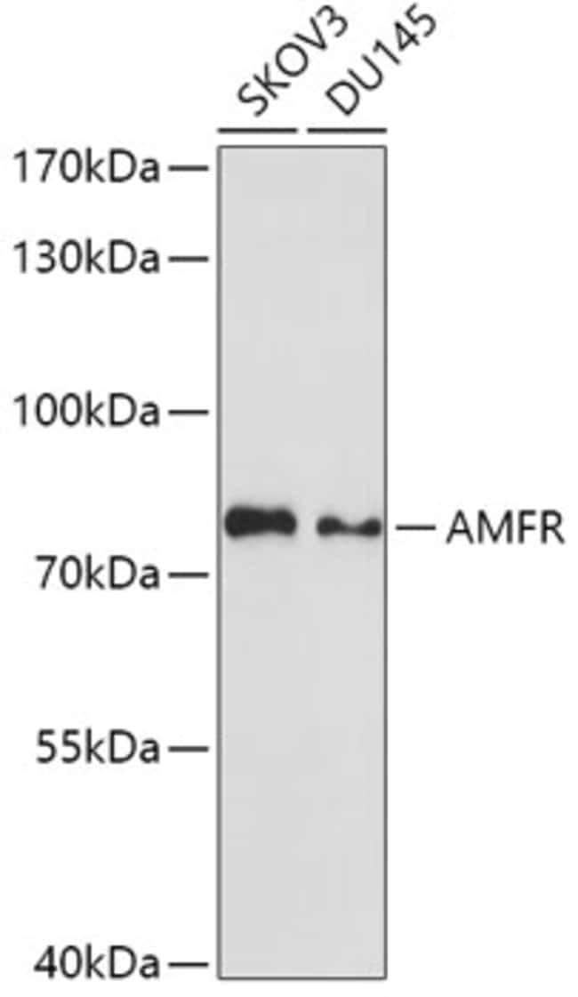 100UL AMFR ANTIBODY 100 ul