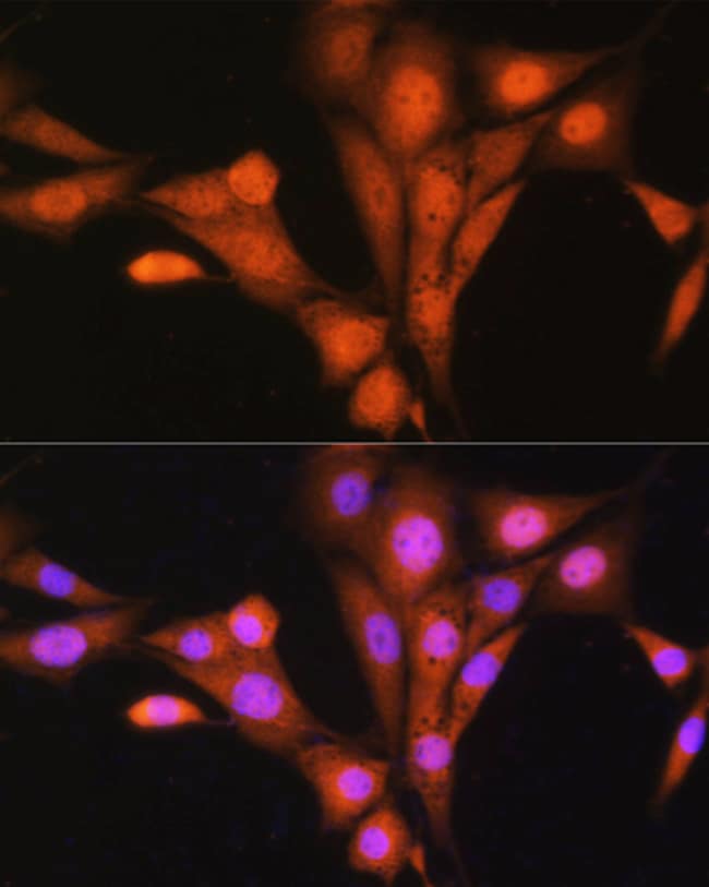 100UL ASNA1 ANTIBODY 100 ul