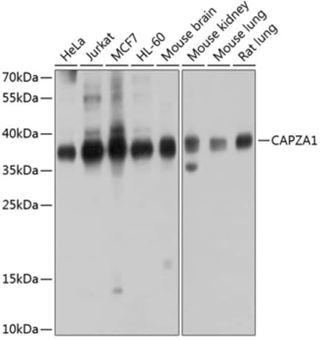 100UL CAPZA1 ANTIBODY 100 ul