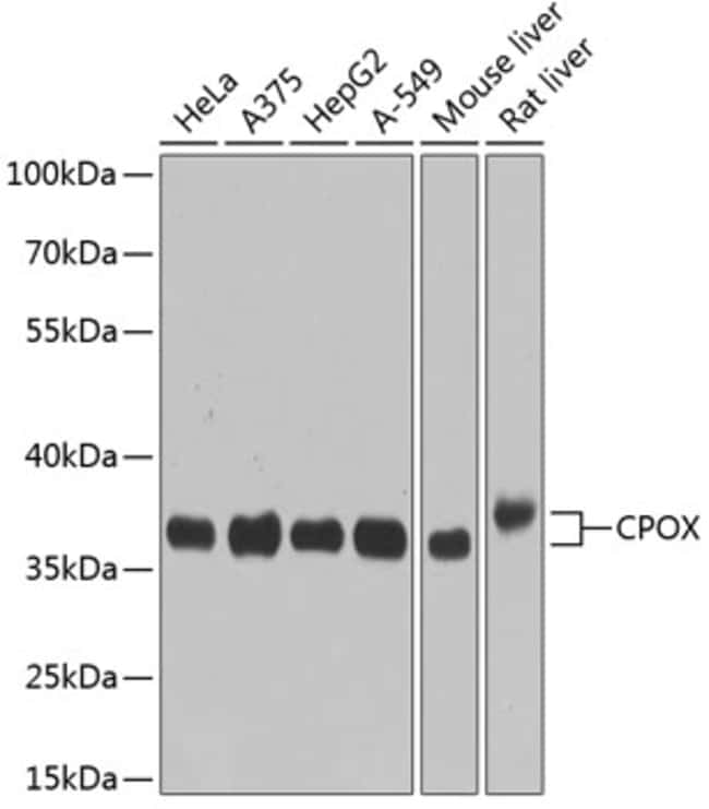 100UL CPOX ANTIBODY 100 ul