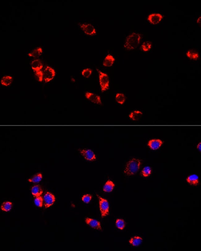 100UL ECHS1 ANTIBODY 100 ul