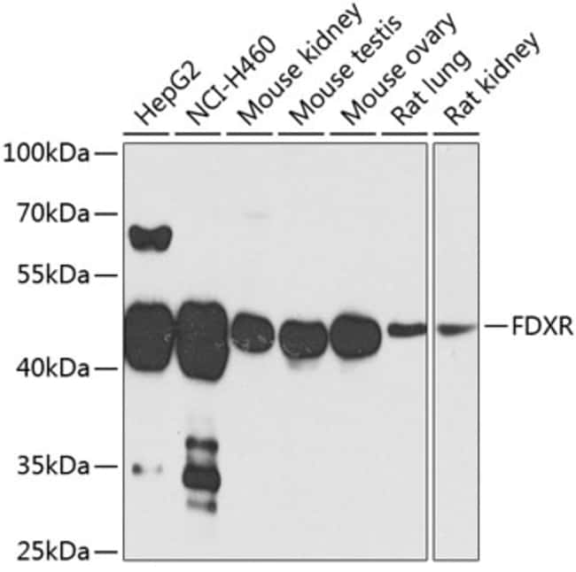 100UL FDXR ANTIBODY 100 ul
