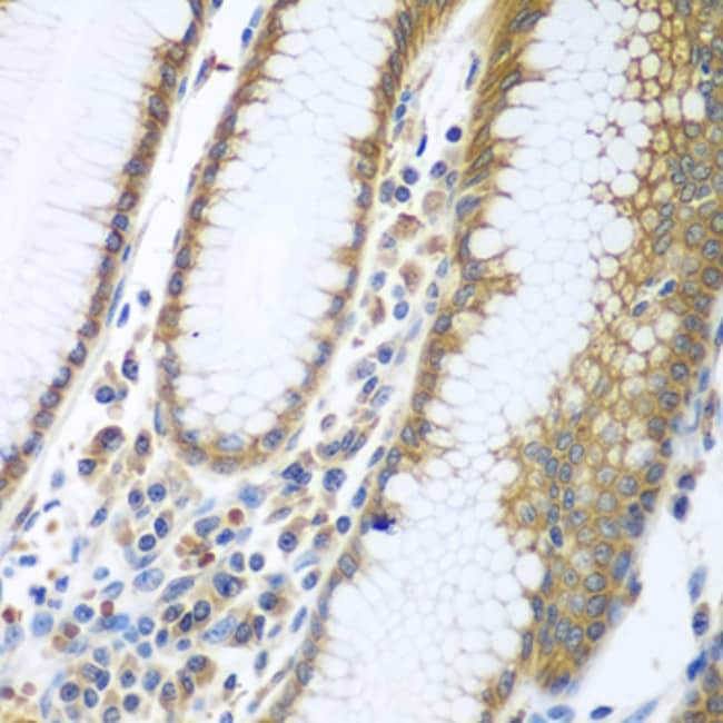 100UL FUT6 ANTIBODY 100 ul