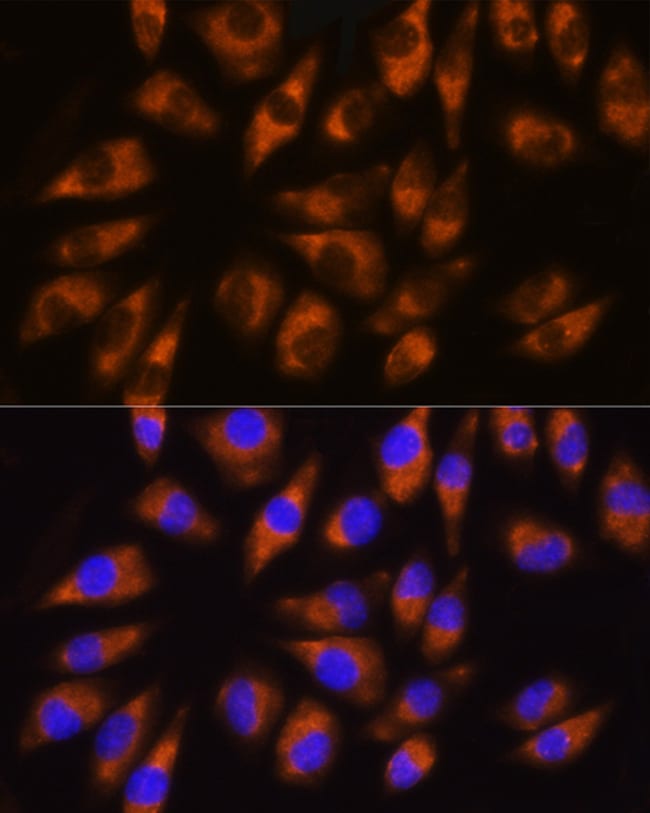 100UL GRK5 ANTIBODY 100 ul