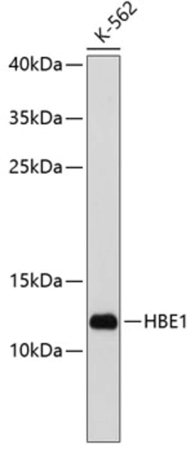 100UL HBE1 ANTIBODY 100 ul