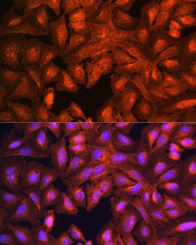 100UL LASP1 ANTIBODY 100 ul