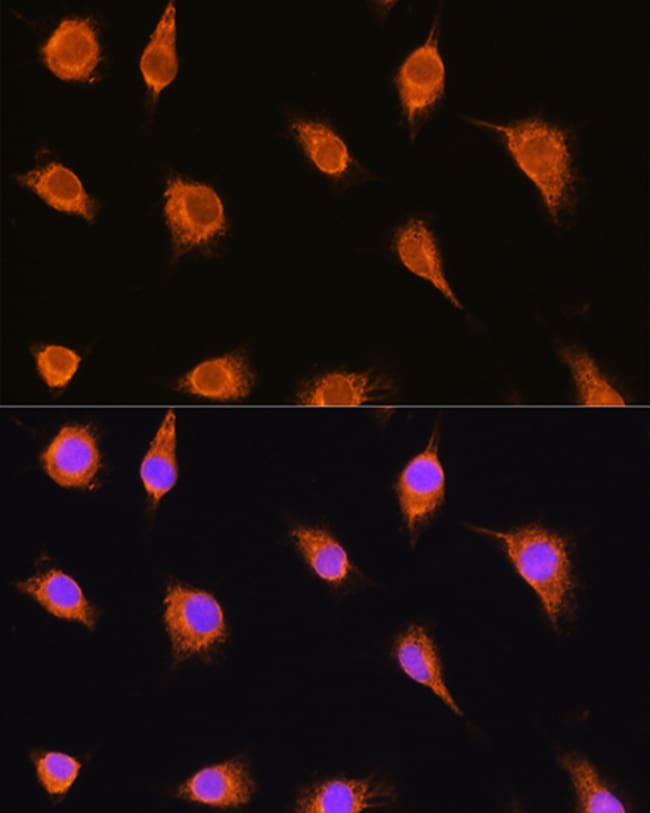 100UL ALPHA SARCOGLYCAN ANTIBODY 100 ul