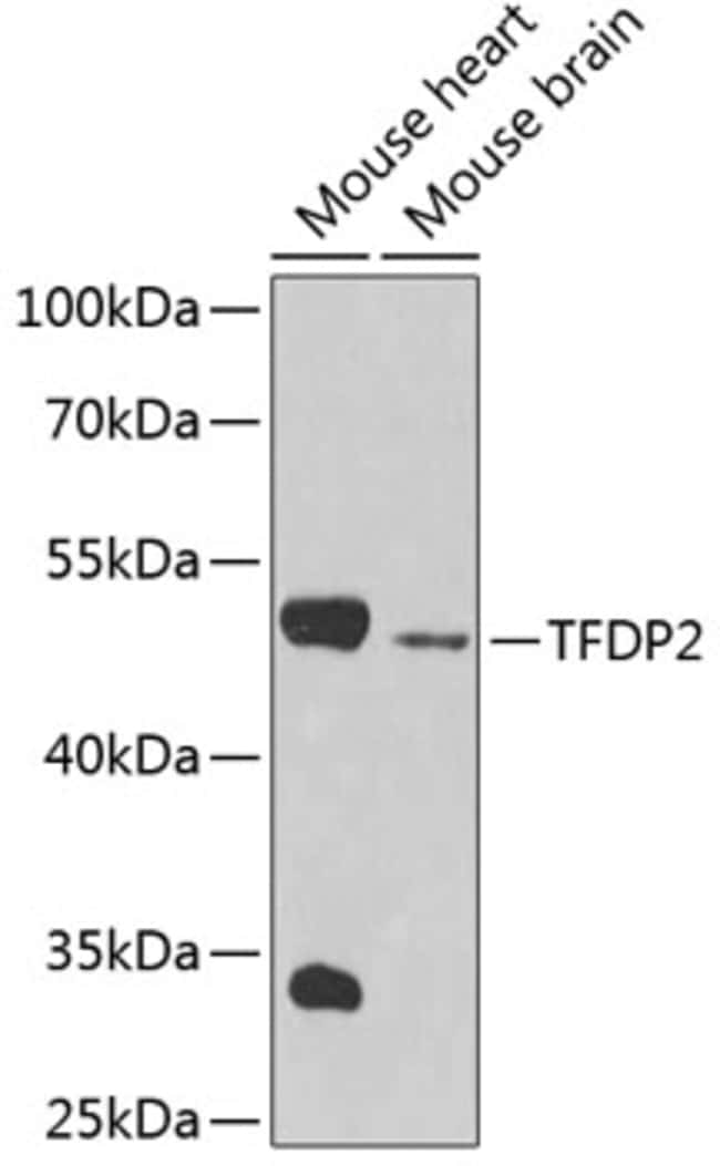 100UL DP2 ANTIBODY 100 ul