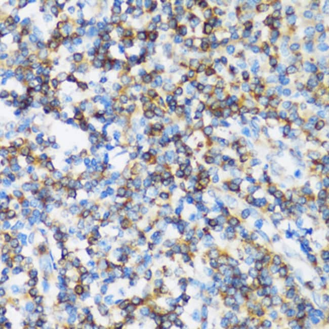 100UL ARHGEF1 ANTIBODY 100 ul