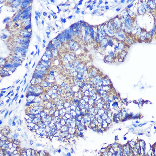 100UL ABCG1 ANTIBODY 100 ul