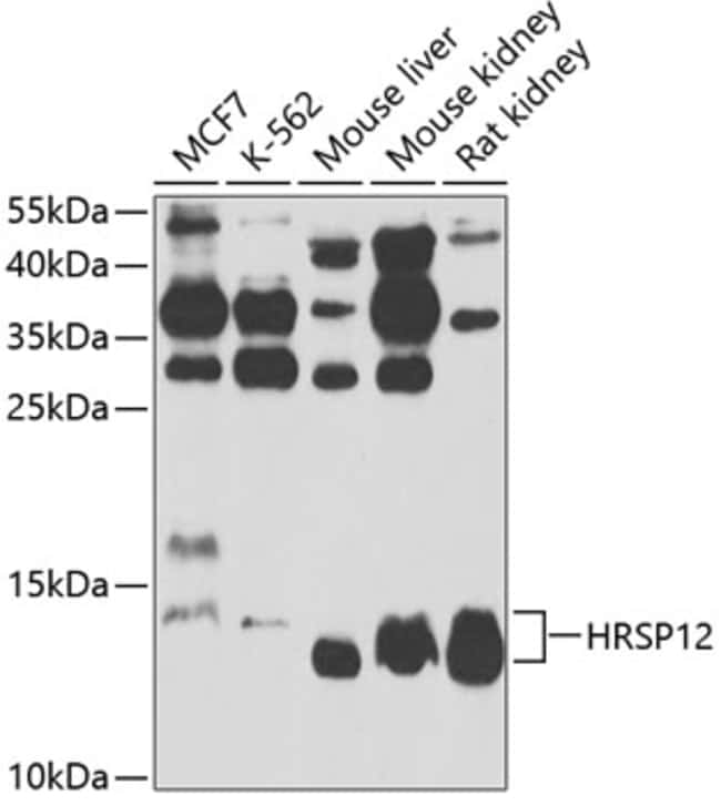 100UL HRSP12 ANTIBODY 100 ul